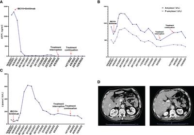 Case Report: Durable complete response of metastatic hepatocellular carcinoma with asymptomatic hyperamylasemia to combined immunotherapy of anti-cytotoxic T lymphocyte-associated antigen 4 plus anti-programmed cell death-1 antibodies